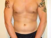 NakedSkier
