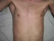 hotmale